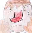 鼻が折れた件について