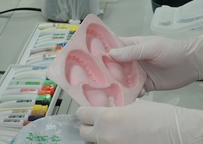 歯列の型