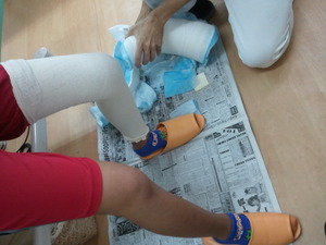 膝前十字靭帯損傷