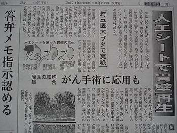 人工シート