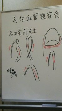 毛細血管からのメッセージ！ 2015/09/11 09:39:48