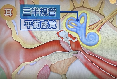 健康管理士は 実はめまいも耳鳴りもスペシャリスト