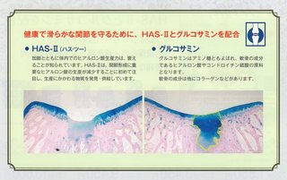 Ｗｉｓｈ関節ＨＡＳーⅡ