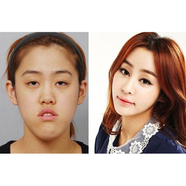 韓国の伝統工芸、美容整形　その１