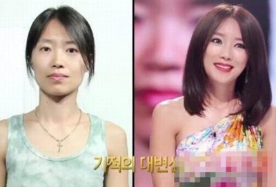 韓国の伝統工芸、美容整形　その１