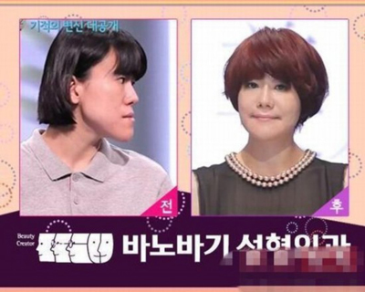 韓国の伝統工芸、美容整形　その１