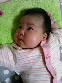 乳児湿疹 2012/03/19 21:21:13